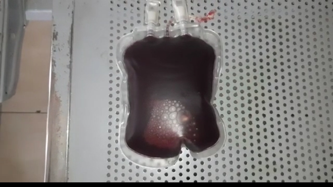 सनसनीखेज : देवघर सदर अस्पताल में नकली खून बेचने वाले सौदागरों का पर्दाफाश