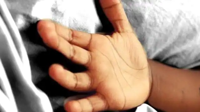 इलाज के दौरान बच्ची की मौत, पिता ने शक में किया था आग के हवाले, जानिए क्या है मामला