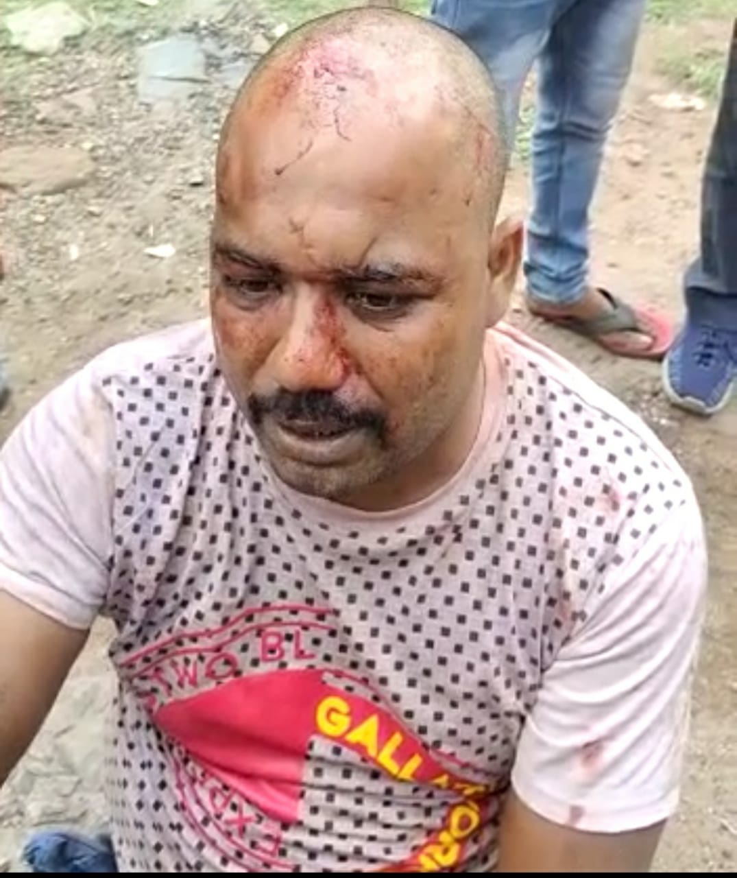 फिर हुई फायरिंग, फिर लगी गोली, जानिए कहां का है मामला 