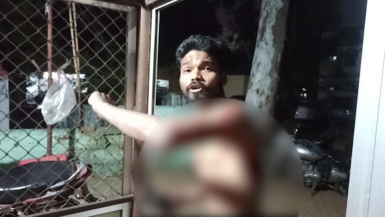 दुमका : दोस्त के भाई ने कर दिया चाकू से हमला, बाल-बाल बची जान